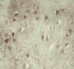 TRAPPC1 Antibody - Azide and BSA Free, Novus Biologicals 0.5 mg; Unconjugated:Antibodies,
